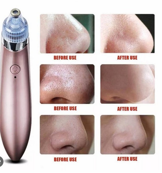 DERMI CLEAR™ Extractor de Puntos Negros y Espinillas